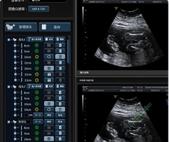 武漢睿影醫療科技超聲系統軟件UI設計